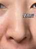 BEAI去黑頭導出液深層清潔收縮毛孔去粉刺閉口il清潔so黑白頭150ml 【去黑頭鼻貼】到手20片 1 曬單實拍圖
