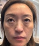 ZHENMI新加坡進口眼霜淡化細紋提拉緊致黑眼圈淡化眼袋抗皺初老護膚品 曬單實拍圖