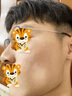 維a酸乳膏 祛痘藥膏祛痘消炎痤瘡專用青春痘祛痘膏臉上額頭長痘痘的藥淋巴痘腮邊痘粉刺祛痘印醫(yī)用皮膚用藥 1盒【精準(zhǔn)祛痘 當(dāng)天看效】 曬單實拍圖