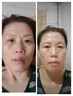 咔詩(shī)迪曼煙酰胺精華液輕奢抗皺緊致童顏液30ml*3瓶補(bǔ)水保濕淡紋精華乳 曬單實(shí)拍圖