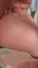 葵花兒童手指脫皮藥膏嚴重手脫皮維生素真菌感染用什么藥開裂癢蛻起皮 寶寶護膚修復(fù)軟膏 曬單實拍圖