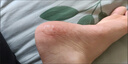 正品真狼毒腳氣王噴劑噴腳王去腳臭腳癢腳部起泡爛腳丫脫皮止癢 1盒裝 曬單實(shí)拍圖