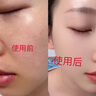 Redact澳洲氨甲環(huán)酸精華液傳明酸5%高濃度濕敷液非醫(yī)用黃褐斑煙酰胺原液 曬單實拍圖