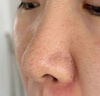 BAJK黑頭導(dǎo)出液鼻子去黑頭粉刺收縮毛孔深層清潔清理神器粗大修復(fù)閉口 【黑頭閉口粉刺】黑頭導(dǎo)出液*1瓶 黑頭粉刺丨收縮毛孔丨無效包退 曬單實(shí)拍圖