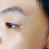 華美科醫(yī)用重組人體表皮生長因子點痣疤痕修復凝膠燙軟膏傷口愈合15g1支 曬單實拍圖