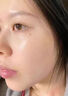 伊生優(yōu)美膠原蛋白重組醫用冷敷貼藍銅肽凍干粉六勝肽冰膜洋甘菊修復面膜 伊生優(yōu)美醫用敷貼 一盒【5片】 曬單實(shí)拍圖