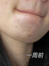 kuvive新加坡進口清潔面膜去黑頭泥膜祛痘粉刺閉口涂抹式收縮毛孔男女士 去黑頭|清潔泥膜150g 曬單實拍圖