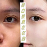 維特絲（vetes）去角質(zhì)面部啫喱控油保濕洗面奶男女士清潔毛孔黑頭閉口溫沒激素和 【6大專利】果酸去角質(zhì)啫喱200g 曬單實拍圖