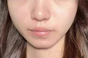 韓方五谷壬二酸祛痘藥膏去痘痘和淡化痘印精華液護(hù)膚品青春痘男女學(xué)生 曬單實(shí)拍圖