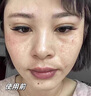 Losoki瑞士進口377面膜美白補水淡斑提亮膚色女男士抗皺緊致抗衰老熬夜 曬單實拍圖