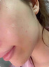 EDRI醫(yī)用三型膠原蛋白美白次拋精華液修復醫(yī)美術后水光針修復皮膚屏障 曬單實拍圖