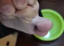角化型足癬腳氣】腳后跟干裂膏真菌感染嚴(yán)重腳氣藥止癢脫皮爛腳丫真菌感染自腳營(yíng)干燥開裂脫皮硝酸咪康唑乳膏 1盒裝【腳后跟干裂疼痛】主圖視覺特效 曬單實(shí)拍圖