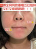 HAPN依克多因水乳套裝 敏感肌舒緩補(bǔ)水保濕護(hù)膚屏障修護(hù)滋潤(rùn)改善泛紅 1瓶精華乳100ml+1瓶柔膚水120ml 曬單實(shí)拍圖