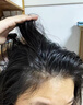 LD男女士專用進(jìn)口原料毛囊去屑止癢控油蓬松除螨炎清潔胖東來洗發(fā)水 二瓶周期裝【健康毛囊無煩惱】 曬單實(shí)拍圖