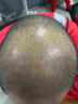 蔓迪生發(fā)噴霧米諾地爾酊90ml瓶5%濃度男女性防脫育發(fā)液藥洗發(fā)水發(fā)際線生長快速生發(fā)增發(fā)凝膠搽劑曼迪 曬單實(shí)拍圖