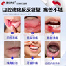 蓬仁藥業(yè)口腔潰瘍修復(fù)凝膠口腔潰瘍專用的藥口舌生瘡上火兒童可搭口腔潰瘍貼可搭口腔潰瘍散西瓜霜口腔潰瘍噴劑一點靈 曬單實拍圖