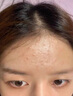 OHBT祛痘膏60g青春痘閉孔粉刺收縮毛孔專用學(xué)生男女凝膠男士化妝品 曬單實拍圖