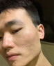 南京同仁堂祛痘膏去痘痘和痘印痘坑修復男女士改善粉刺閉口30g 曬單實拍圖