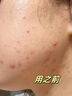 Losoki瑞士進(jìn)口氨基酸洗面奶美白控油祛痘除螨蟲去黑頭男女士專用潔面乳 曬單實(shí)拍圖