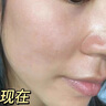 透真美白淡斑精華液 377抗皺緊致美白提亮 577祛斑緊致去黃vc精華 曬單實拍圖