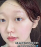 Newliann醫(yī)用重組人表皮生長因子噴霧外用修復皮膚屏障凝膠原蛋白補水保濕 曬單實拍圖