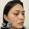 透真377美白精華液次拋淡化黑色素祛斑去黃提亮改善暗沉膚色煙酰胺女 曬單實(shí)拍圖