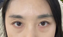 冰膚之萃眼袋貼去眼袋消除重度眼袋中老年專用去除神器男女士專用眼霜進口 一盒【60片】體驗裝 曬單實拍圖