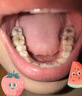 李時(shí)珍防蛀牙膏蛀牙洞修復(fù)齲牙齒成人兒童殺蟲修復(fù)齒洞清理黑線蟲牙爛牙 專用的藥【一盒裝】試用裝 曬單實(shí)拍圖