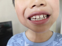 拜爾K6 兒童電動牙刷  智能掃振全身防水 小學生男寶寶小孩軟毛護齦感應充電 3-6-12送孩子禮物 迪西藍 曬單實拍圖