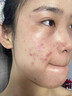 BEAUTY NOTES硫磺洗面奶控油祛痘除螨蟲去黑頭青少年女男士專用潔面乳洗臉皂 曬單實拍圖