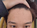 Losoki瑞士進(jìn)口氨基酸洗面奶祛痘深層清潔美白控油去黑頭收縮毛孔男女士 曬單實(shí)拍圖