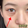 焦博士日本眼霜去眼袋消除重度眼袋專用黑眼圈重度去除女男士中老年神器 曬單實(shí)拍圖