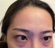 藤石制藥腫眼泡去脂消腫眼腫搭消除冰敷眼貼眼睛腫脹脂肪厚眼皮神器藥貼MW 1盒試用【用眼疲勞眼浮腫醫(yī)用護眼貼】拆用不滿可退 曬單實拍圖