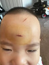 邦孚手美國進(jìn)口硅酮去祛疤痕修復(fù)凝膠醫(yī)用醫(yī)院專用去疤膏兒童手術(shù)縫針 曬單實(shí)拍圖