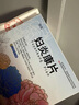 [德鑫]婦炎康片 0.25g*144片 3盒裝 婦科用藥 非處方藥婦科消炎藥 治多種婦科炎癥專(zhuān)用藥口服盆腔炎宮頸炎陰道瘙癢異味 白帶多 色黃氣臭 曬單實(shí)拍圖