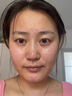 ESTHER FORMULA韓國艾思得谷胱甘肽美白內(nèi)服全身內(nèi)調(diào)煙酰胺抗糖飲美白丸片 曬單實(shí)拍圖