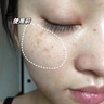 FIONA STILES左旋vc醫(yī)用美白淡斑左旋維c固態(tài)精華片+煙酰胺原液100%377精華液 左旋vc精華片1盒 美白提亮去黃改善暗沉膚色 曬單實(shí)拍圖