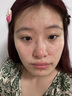 維特絲祛痘藥膏50g壬二酸水楊酸去痘痘和收毛孔閉口粉刺男女精華 曬單實拍圖