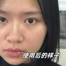 奈皙日本曬后修復面膜急救敏感泛紅女男士夏季神經酰胺改善醫(yī)美用煥白 曬單實拍圖