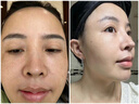 小野拓司幹細(xì)胞斷黑·碳酸面膜 1次=3次高端項(xiàng)目 瓷光雪白少女肌 1瓶·初體驗(yàn) 送刮板:上臉+卸臉 曬單實(shí)拍圖