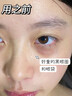 焦博士日本眼膜眼袋貼提拉緊致抗皺淡化細(xì)紋黑眼圈去眼貼膜眼袋眼紋專用 曬單實(shí)拍圖