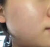 伊生優(yōu)美膠原蛋白重組醫(yī)用冷敷貼藍(lán)銅肽凍干粉六勝肽冰膜洋甘菊修復(fù)面膜 伊生優(yōu)美冷敷貼【藍(lán)色】 一盒【5片】 曬單實拍圖