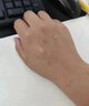 YYTISS祛疤膏疤痕專用修復(fù)除疤膏醫(yī)用硅酮疤痕凝膠兒童增生凸起去除疙瘩 曬單實拍圖