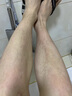 廬太醫(yī)天氣熱皮膚瘙癢腿癢小腿皮膚癢身上起紅疙瘩長紅點(diǎn)皮膚干燥癢炎 一盒裝 曬單實(shí)拍圖
