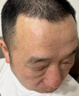 碧素堂（BISUTANG）抬頭紋去除男額頭眉間川字紋貼法令紋消除神器提拉緊致皺紋女專用 50片【鞏固裝】抗皺淡紋【10盒】 曬單實拍圖