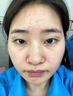 片仔癀（PZH）DR.XME 向美博士硫磺洗面奶控油深層清潔除油凈螨蟲痘痘毛孔堵塞 硫磺洗面奶1支裝 曬單實(shí)拍圖