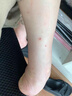 跳蚤藥專用殺蟲劑床上家用室內(nèi)無毒滅跳蚤虱子人用貓狗驅(qū)除蟲神器 買2送1【快速滅殺跳蚤】 曬單實(shí)拍圖