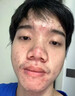南京同仁堂祛痘膏去痘痘和痘印痘坑修復(fù)男女士改善粉刺閉口30g 曬單實拍圖