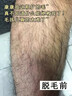 珂森博士 DR.KEROSEN法國(guó)高端脫毛膏男士專用私處胡須腋下手腿毛全身永久去根不再生長(zhǎng) 【專攻粗硬毛質(zhì)】男士脫毛膏 曬單實(shí)拍圖
