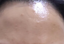 越洋狼毒軟膏狼毒癬癢寧蘚癢靈草本止乳膏千年奇草軟膏皮膚外用 淺黃色 5瓶 (鞏固裝) 曬單實(shí)拍圖